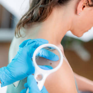 Succes van anti-kankertherapie door AI voorspelt